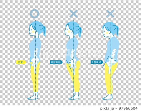 Sample of good and bad posture of women _ pelvis 97966604