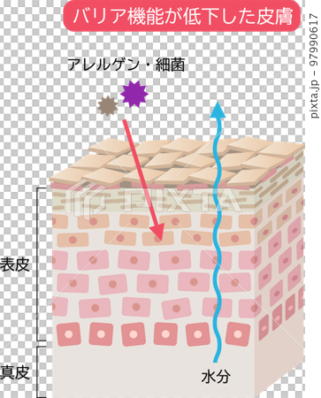 バリア機能が低い皮膚　肌細胞と断面図　立体 97990617