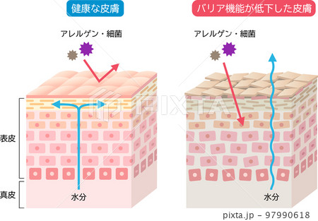乾燥肌とバリア機能の整った健康な皮膚　肌細胞と断面図　立体 97990618