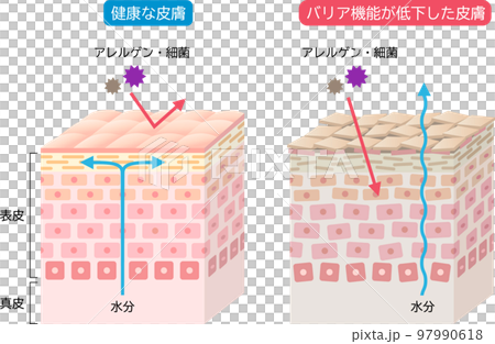 Dry skin and healthy skin with a well-developed barrier function Skin cells and a cross-sectional view 3D 97990618