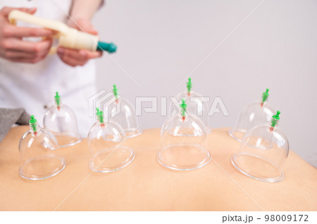 Female massage therapist uses vacuum cans on the patient's back.  98009172