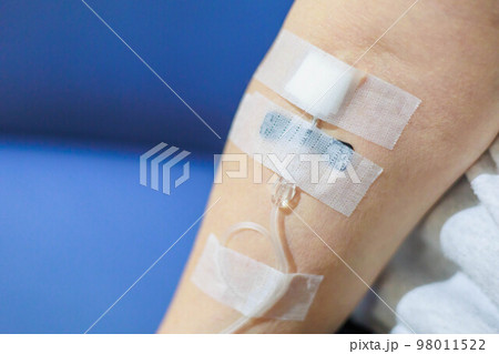 点滴・輸液「医療用具」 点滴・輸液「医療用具」 98011522