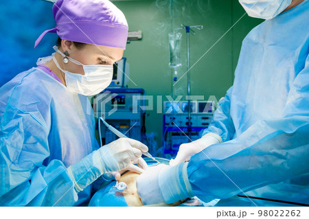 A female surgeon with an electric coagulator operates on a patient. 98022262