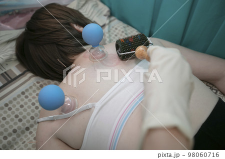The doctor makes the patient acupuncture and vacuum massage. The doctor makes the patient acupuncture and vacuum massage. 98060716
