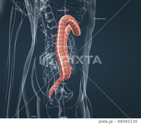 Appendicitis is a painful swelling of the appendix. Appendicitis is a painful swelling of the appendix. 98085230