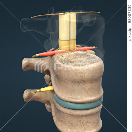 The spinal nerve is a mixed nerve that carries motor, sensory and autonomic signals between the spinal cord and the body The spinal nerve is a mixed nerve that carries motor, sensory and autonomic signals between the spinal cord and the body 98087839