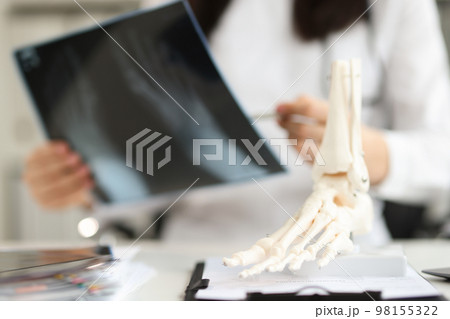 Doctor holds x-ray of foot and anatomy of bones of leg Doctor holds x-ray of foot and anatomy of bones of leg 98155322