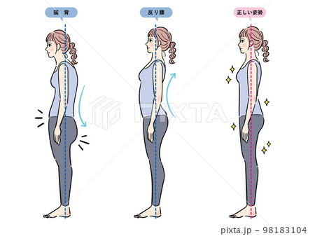 悪い姿勢と正しい姿勢のセット 悪い姿勢と正しい姿勢のセット 98183104