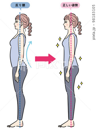 反り腰と正しい姿勢のセット 98183105