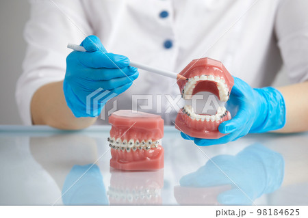 Orthodontist showing model of human jaw with wire braces and aligners explaining the difference 98184625