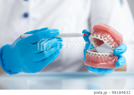 Doctor orthodontist showing model of human jaw with wire braces attached 98184632