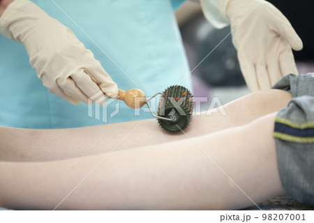 The doctor makes the patient acupuncture and vacuum massage. The doctor makes the patient acupuncture and vacuum massage. 98207001