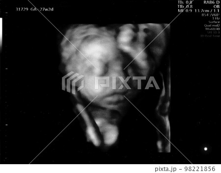 妊娠27週目の胎児のエコー写真 妊娠27週目の胎児のエコー写真 98221856