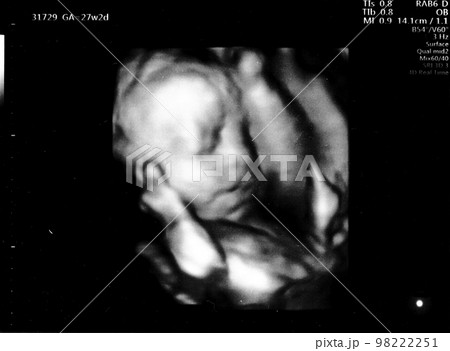 妊娠27週目の胎児のエコー写真 98222251