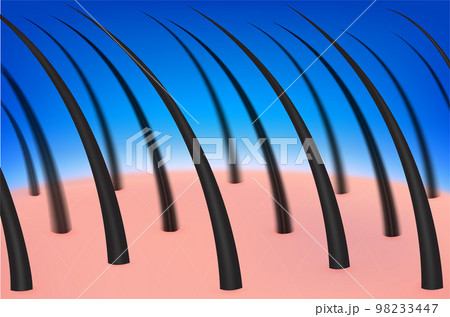 Healthy hair and scalp. Realistic 3D vector illustration. Medical science health concept. For advertisement beauty clinic, cosmetic and banner. 98233447