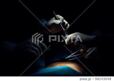 Closeup surgical team performing surgery to patient in sterile operating room. 98243048
