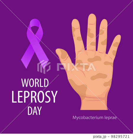 World Leprosy Day. Banner with sick hands and a purple ribbon, a symbol of the fight against leprosy. Medicine concept. Poster, vector World Leprosy Day. Banner with sick hands and a purple ribbon, a symbol of the fight against leprosy. Medicine concept. Poster, vector 98295721