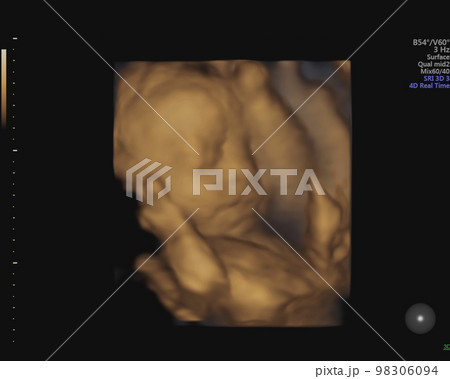 妊娠27週目3Dエコー写真 98306094