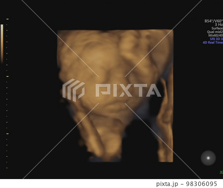 妊娠27週目3Dエコー写真 98306095