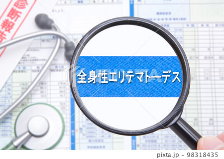 全身性エリテマトーデス(SLE) 全身性エリテマトーデス(SLE) 98318435