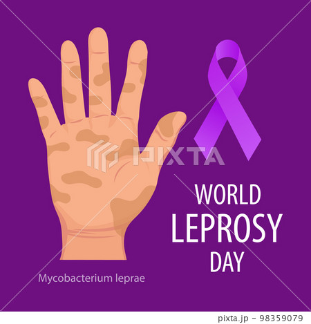 World Leprosy Day. Banner with sick hand and a purple ribbon, a symbol of the fight against leprosy. Medicine concept. Poster, vector 98359079
