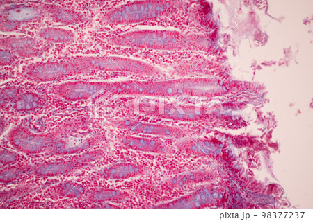 Tissue of Small intestine (Duodenum), Large intestine Human and Stomach Human under the microscope in Lab. Tissue of Small intestine (Duodenum), Large intestine Human and Stomach Human under the microscope in Lab. 98377237