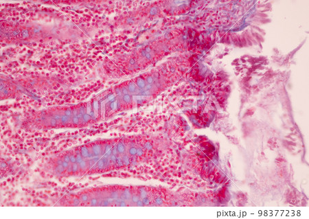 Tissue of Small intestine (Duodenum), Large intestine Human and Stomach Human under the microscope in Lab. Tissue of Small intestine (Duodenum), Large intestine Human and Stomach Human under the microscope in Lab. 98377238