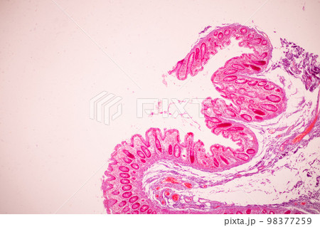 Tissue of Small intestine (Duodenum), Large intestine Human and Stomach Human under the microscope in Lab. Tissue of Small intestine (Duodenum), Large intestine Human and Stomach Human under the microscope in Lab. 98377259