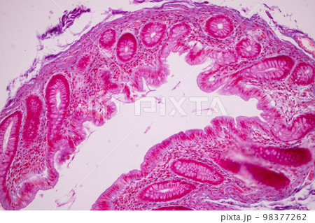 Tissue of Small intestine (Duodenum), Large intestine Human and Stomach Human under the microscope in Lab. 98377262