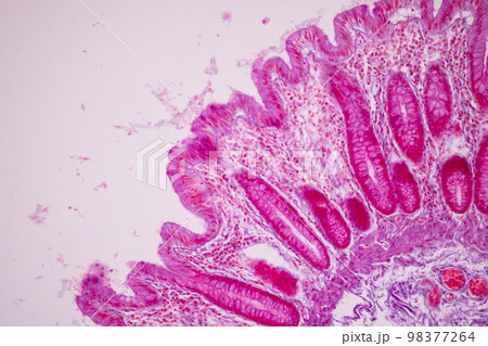Tissue of Small intestine (Duodenum), Large intestine Human and Stomach Human under the microscope in Lab. Tissue of Small intestine (Duodenum), Large intestine Human and Stomach Human under the microscope in Lab. 98377264