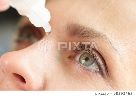 Close up of woman applying eye drops. Close up of woman applying eye drops. 98393462