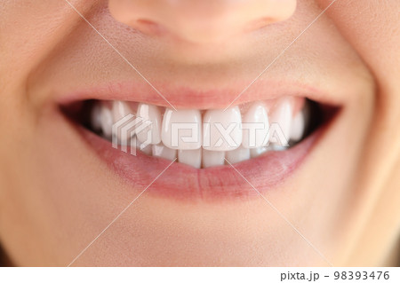 Close-up of healthy smooth white teeth smile. 98393476