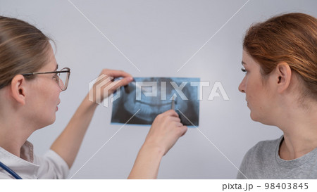 A woman doctor and a patient at the reception are discussing an x-ray of the jaw. 98403845