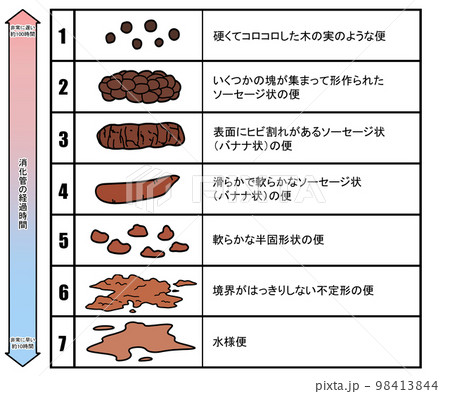 ブリストル便性状スケール 98413844