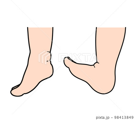 尖足・踵足 98413849
