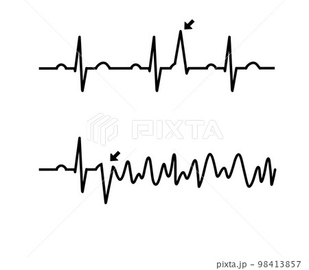 RonTの心電図 98413857