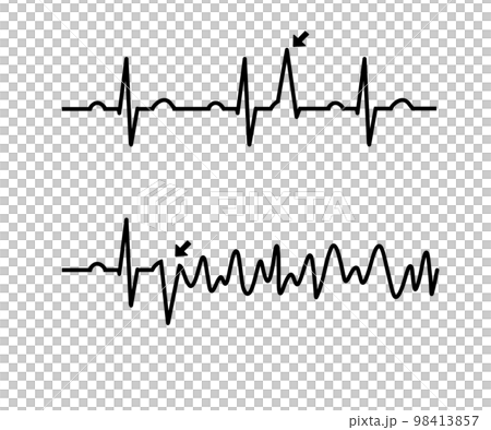 RonTの心電図 98413857