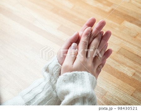 しもやけ・あかぎれで腫れた女性の手 98430521