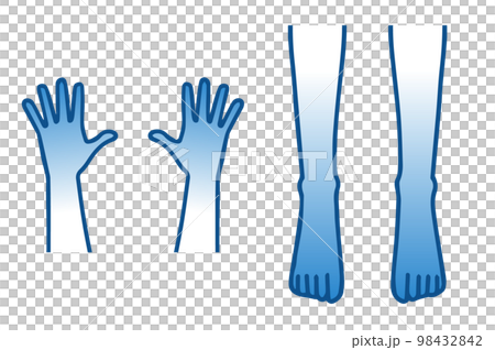 sensitivity to cold, cold hands, cold feet,... - Stock Illustration ...