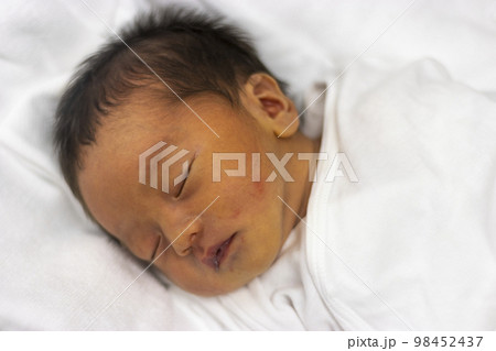 早産で保育器に入っっている赤ちゃんの上半身(新生児、日本人、男の子) 早産で保育器に入っっている赤ちゃんの上半身(新生児、日本人、男の子) 98452437