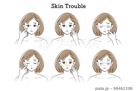 お肌のトラブルのイラストセット(ボブカット/セミロングの女性) お肌のトラブルのイラストセット(ボブカット/セミロングの女性) 98462206