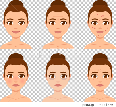 Skin concerns woman face set Skin concerns woman face set 98471776