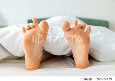 Funny female bare feet with crooked fingers in close-up. White bedding. Dry soles. Concept of pedicure and rest 98475479