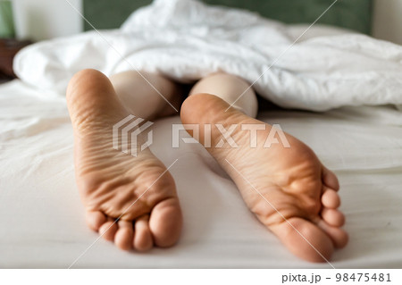 Person's legs sticking out under blanket. Barefeet close-up with dry calluses and corns 98475481