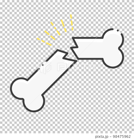 ポキッと二つに折れた骨 - 骨折のイメージ素材 - シンプルでおしゃれなイラスト  98475962
