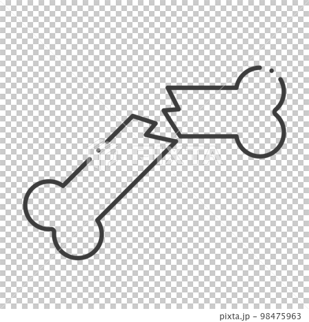 ポキッと二つに折れた骨 - 骨折のイメージ素材 - シンプルでおしゃれなイラスト  98475963