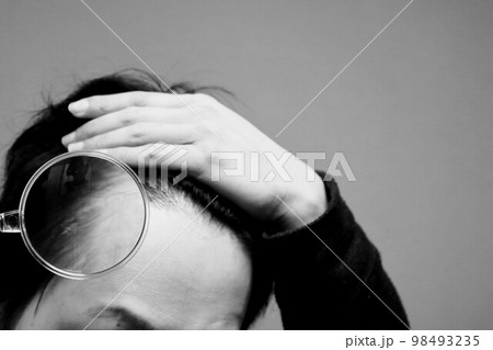 薄毛に悩む男性 98493235