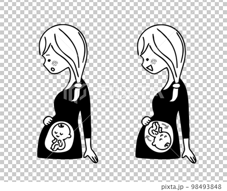 孕婦臀位單色 98493848