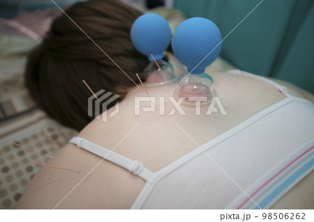 The doctor makes the patient acupuncture and vacuum massage. The doctor makes the patient acupuncture and vacuum massage. 98506262