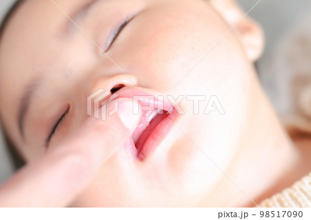 上の前歯が生え始めた赤ちゃん　こんにち歯　生後9ヶ月 98517090